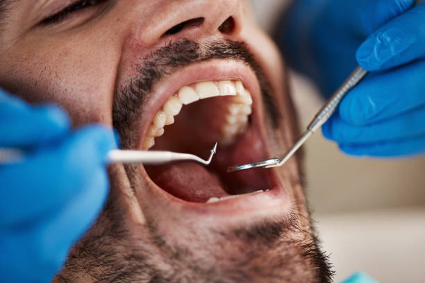 Best Dental Fillings (Composite and Amalgam)  in Orange Grove, TX